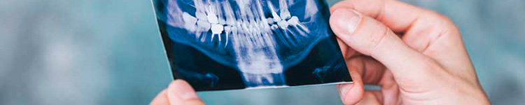 Рентген зубов в Бутово